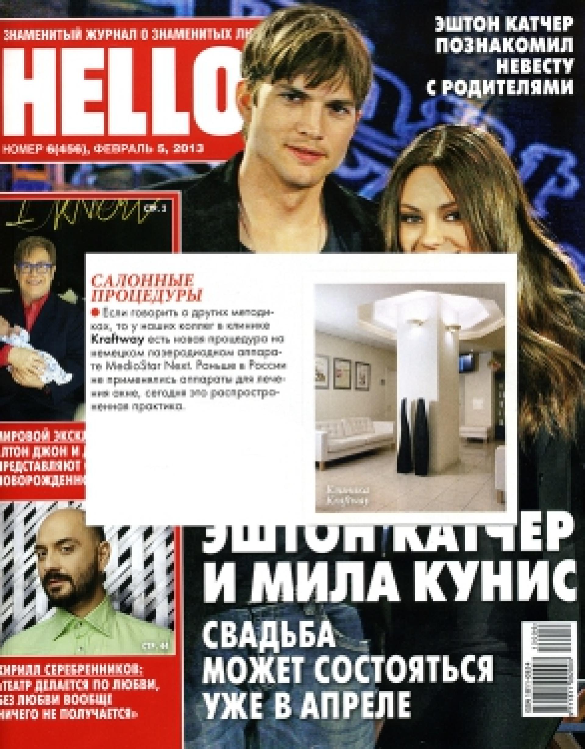 Лечение акне с помощью лазера (Hello, февраль 2013)